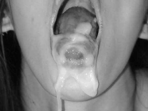 Spermos daug burnoje